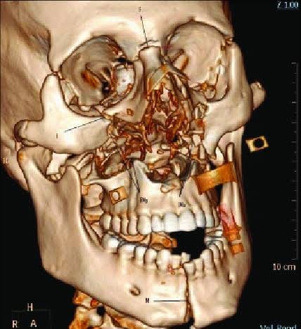 WhatsApp Image 2025-12-22 at 12.32.42 PM